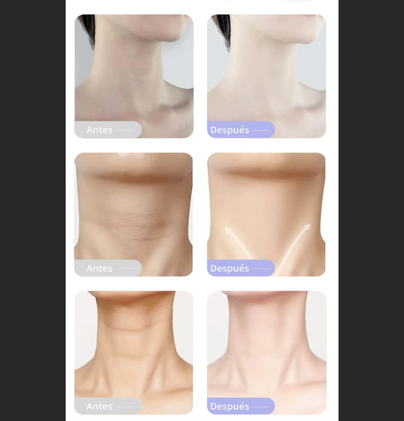 Crema Re-Afirmante para cuello y papada rejuvenecedora elimina arrugas